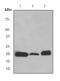 Myoglobin antibody, ab77232, Abcam, Western Blot image 