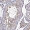 Cilia And Flagella Associated Protein 70 antibody, NBP2-32689, Novus Biologicals, Immunohistochemistry paraffin image 