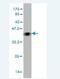 ALK Receptor Tyrosine Kinase antibody, H00000238-M01, Novus Biologicals, Western Blot image 