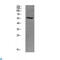 SMAD Family Member 3 antibody, LS-C813506, Lifespan Biosciences, Western Blot image 