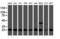 Proteasome Subunit Beta 9 antibody, LS-C173796, Lifespan Biosciences, Western Blot image 