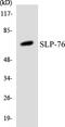 Lymphocyte Cytosolic Protein 2 antibody, LS-C200704, Lifespan Biosciences, Western Blot image 