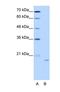 Nucleolar Protein 6 antibody, NBP1-57231, Novus Biologicals, Western Blot image 