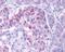 Inhibitor Of Nuclear Factor Kappa B Kinase Subunit Epsilon antibody, NBP1-76800, Novus Biologicals, Immunohistochemistry frozen image 