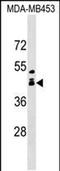 ALX Homeobox 1 antibody, PA5-48910, Invitrogen Antibodies, Western Blot image 