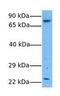 Aspartyl/asparaginyl beta-hydroxylase antibody, GTX45857, GeneTex, Western Blot image 