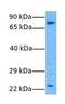 Aspartate Beta-Hydroxylase antibody, GTX45857, GeneTex, Western Blot image 