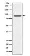 Lactotransferrin antibody, M00633, Boster Biological Technology, Western Blot image 