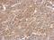 Serine/threonine-protein kinase PAK 6 antibody, NBP2-19685, Novus Biologicals, Immunohistochemistry paraffin image 