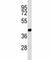 Protein Arginine Methyltransferase 6 antibody, F40469-0.4ML, NSJ Bioreagents, Immunohistochemistry paraffin image 