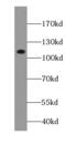 ATPase Na+/K+ Transporting Subunit Alpha 1 antibody, FNab00692, FineTest, Western Blot image 