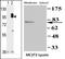 cGMP-dependent protein kinase 2 antibody, AP14907PU-N, Origene, Western Blot image 