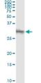Dickkopf WNT Signaling Pathway Inhibitor 1 antibody, H00022943-M11, Novus Biologicals, Immunoprecipitation image 