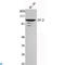 Eukaryotic Translation Elongation Factor 2 antibody, LS-C812950, Lifespan Biosciences, Western Blot image 