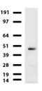 Carbonic Anhydrase 12 antibody, LS-C796773, Lifespan Biosciences, Western Blot image 