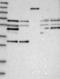 CDK5 Regulatory Subunit Associated Protein 3 antibody, NBP1-86778, Novus Biologicals, Western Blot image 