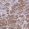 TGFB1-Induced Anti-Apoptotic Factor 1 antibody, NBP2-13430, Novus Biologicals, Immunohistochemistry paraffin image 