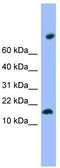 Transmembrane Protein 42 antibody, TA340343, Origene, Western Blot image 