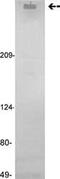 Coagulation factor VIII antibody, ab78852, Abcam, Western Blot image 