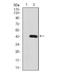 Platelet Derived Growth Factor Receptor Beta antibody, NBP2-52529, Novus Biologicals, Western Blot image 