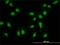 Mediator Complex Subunit 17 antibody, H00009440-M02, Novus Biologicals, Immunocytochemistry image 