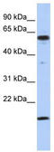 Thyroid Hormone Receptor Interactor 10 antibody, TA343450, Origene, Western Blot image 