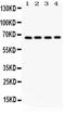 Optineurin antibody, LS-C357528, Lifespan Biosciences, Western Blot image 