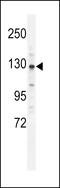 CAP-Gly Domain Containing Linker Protein 2 antibody, LS-C159427, Lifespan Biosciences, Western Blot image 