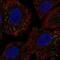 Coiled-Coil Domain Containing 65 antibody, PA5-66092, Invitrogen Antibodies, Immunofluorescence image 