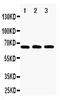 TNF Receptor Superfamily Member 11a antibody, GTX11697, GeneTex, Western Blot image 
