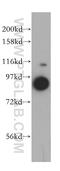 VPS16 Core Subunit Of CORVET And HOPS Complexes antibody, 17776-1-AP, Proteintech Group, Western Blot image 