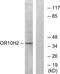 Olfactory Receptor Family 10 Subfamily H Member 2 antibody, A16363, Boster Biological Technology, Western Blot image 