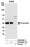 Vacuolar protein sorting-associated protein VTA1 homolog antibody, A304-828A, Bethyl Labs, Immunoprecipitation image 