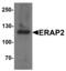 Endoplasmic Reticulum Aminopeptidase 2 antibody, MBS153649, MyBioSource, Western Blot image 