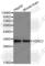 Voltage Dependent Anion Channel 2 antibody, A3648, ABclonal Technology, Western Blot image 