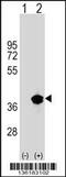 Palmitoyl-Protein Thioesterase 1 antibody, 58-985, ProSci, Western Blot image 