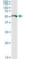 Cytochrome P450 Family 4 Subfamily X Member 1 antibody, H00260293-D01P, Novus Biologicals, Western Blot image 