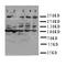 ATM Serine/Threonine Kinase antibody, PA1784, Boster Biological Technology, Western Blot image 