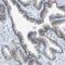 CD46 Molecule antibody, NBP1-82790, Novus Biologicals, Immunohistochemistry frozen image 