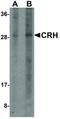 Corticotropin Releasing Hormone antibody, LS-C336175, Lifespan Biosciences, Western Blot image 