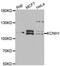 Potassium Voltage-Gated Channel Subfamily H Member 1 antibody, A6636, ABclonal Technology, Western Blot image 