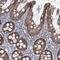 KRAS Proto-Oncogene, GTPase antibody, NBP2-33579, Novus Biologicals, Immunohistochemistry frozen image 