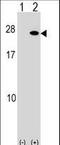 Fibroblast Growth Factor 19 antibody, LS-C159649, Lifespan Biosciences, Western Blot image 