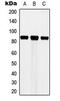 Cortactin antibody, LS-C353974, Lifespan Biosciences, Western Blot image 