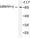 Junction Plakoglobin antibody, LS-B9801, Lifespan Biosciences, Western Blot image 