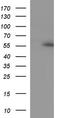 Ankyrin repeat and MYND domain-containing protein 2 antibody, TA507307, Origene, Western Blot image 