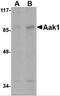 AP2 Associated Kinase 1 antibody, 4831, ProSci, Western Blot image 