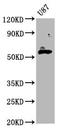 Glutamic--Pyruvic Transaminase 2 antibody, LS-C680556, Lifespan Biosciences, Western Blot image 