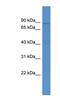 ATP Binding Cassette Subfamily B Member 10 antibody, NBP1-69066, Novus Biologicals, Western Blot image 