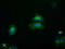 Fyn Related Src Family Tyrosine Kinase antibody, LS-C172340, Lifespan Biosciences, Immunofluorescence image 